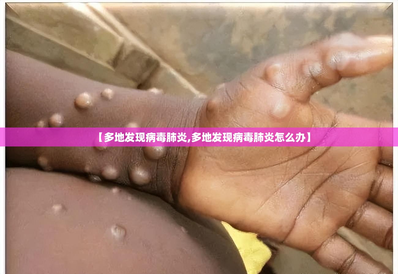 【多地发现病毒肺炎,多地发现病毒肺炎怎么办】 【多地发现病毒肺炎,多地发现病毒肺炎怎么办】