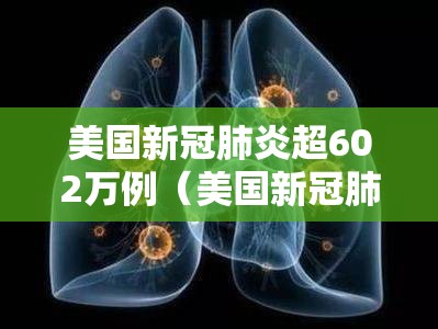 美国新冠肺炎超602万例(美国新冠肺炎超2908万例) 美国新冠肺炎超602万例(美国新冠肺炎超2908万例)
