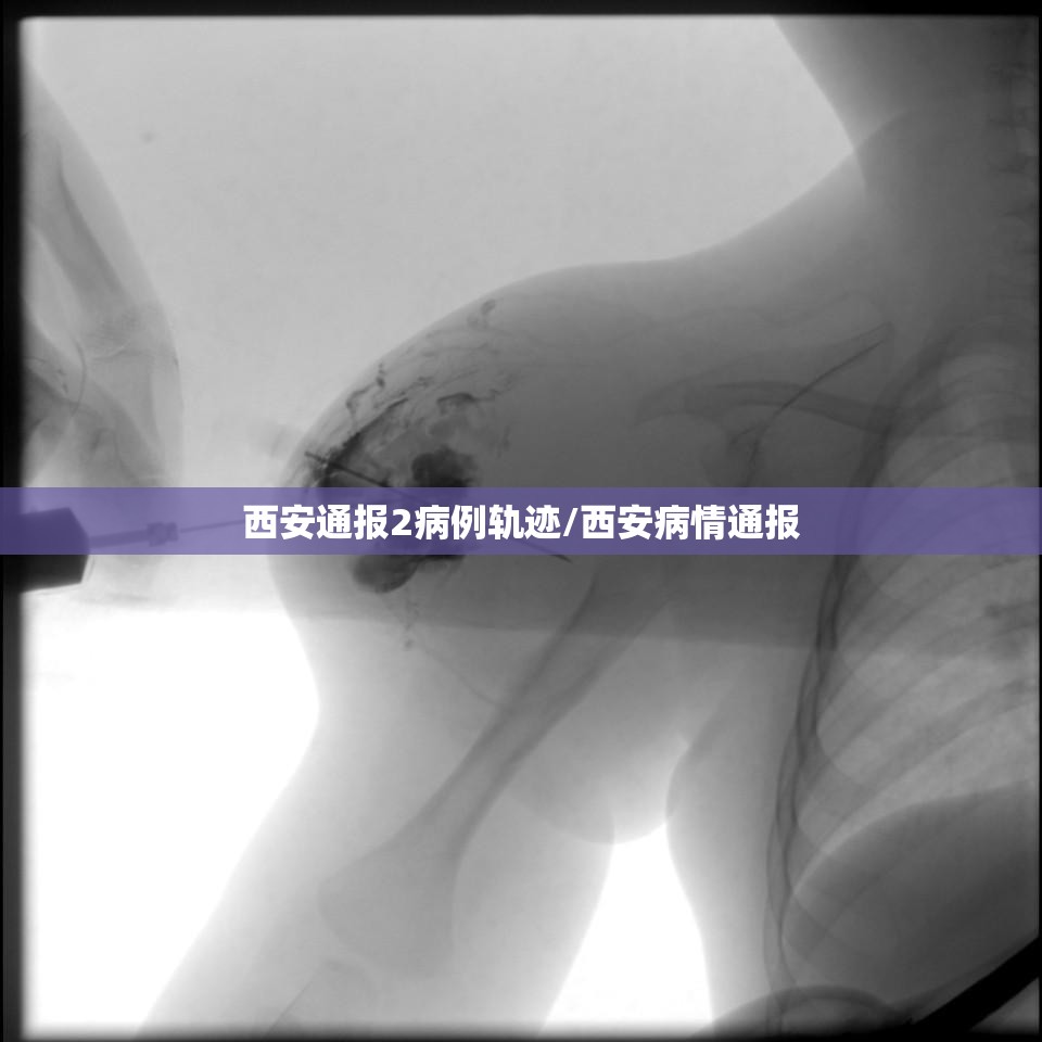 西安通报2病例轨迹/西安病情通报 西安通报2病例轨迹/西安病情通报
