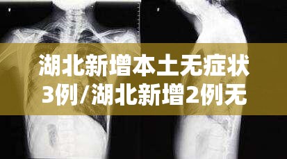 湖北新增本土无症状3例/湖北新增2例无症状