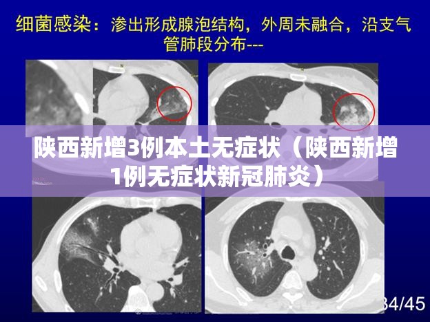 陕西新增3例本土无症状（陕西新增1例无症状新冠肺炎）