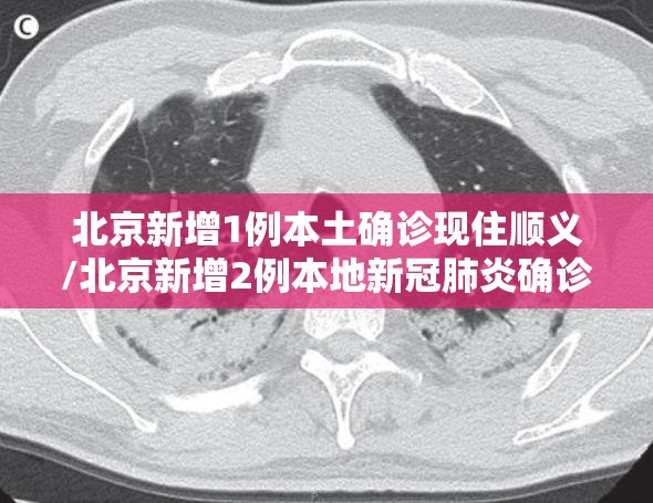 北京新增1例本土确诊现住顺义/北京新增2例本地新冠肺炎确诊病例 均在顺义区