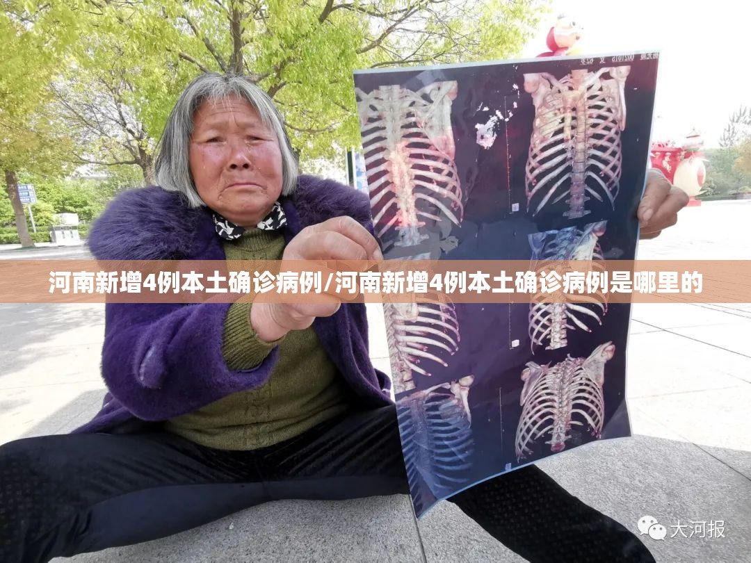 河南新增4例本土确诊病例/河南新增4例本土确诊病例是哪里的