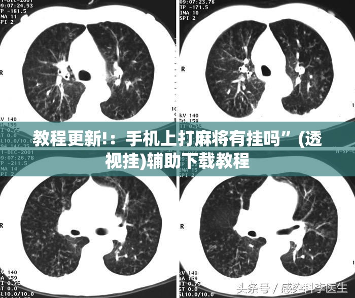 教程更新!：手机上打麻将有挂吗”(透视挂)辅助下载教程