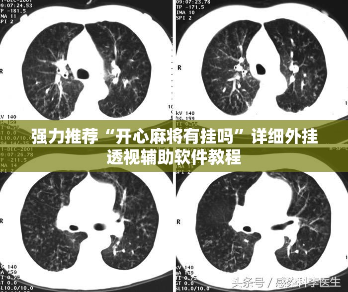 强力推荐“开心麻将有挂吗	”详细外挂透视辅助软件教程