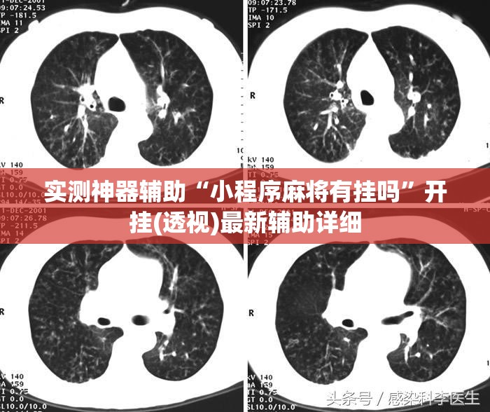 实测神器辅助“小程序麻将有挂吗	”开挂(透视)最新辅助详细