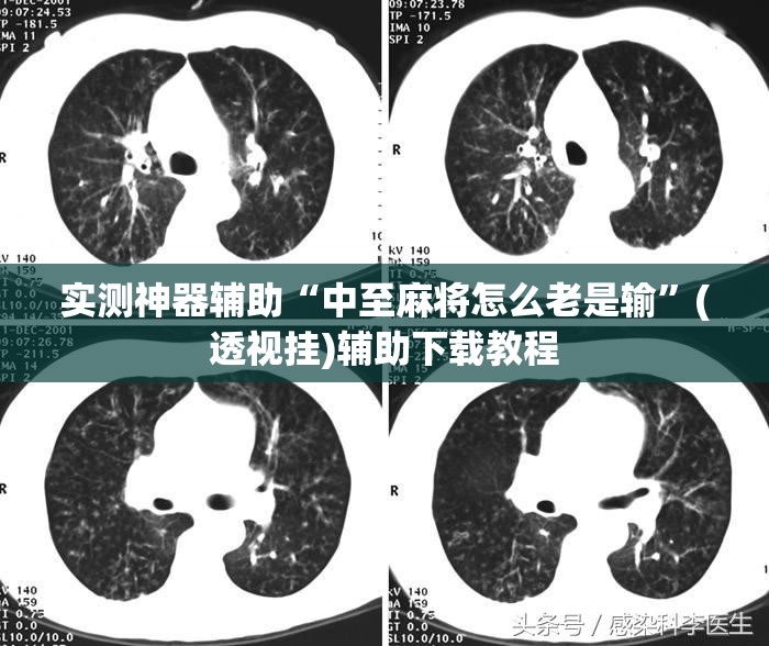 实测神器辅助“中至麻将怎么老是输	”(透视挂)辅助下载教程