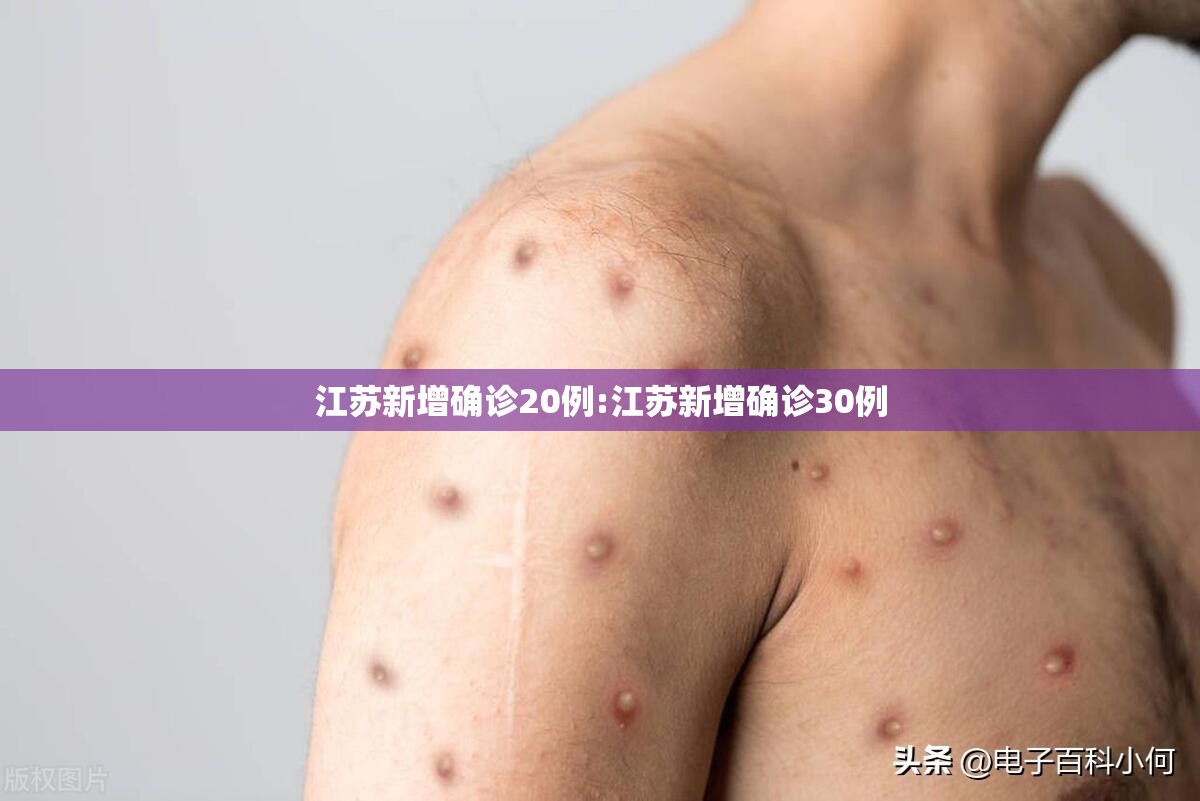 江苏新增确诊20例:江苏新增确诊30例 江苏新增确诊20例:江苏新增确诊30例