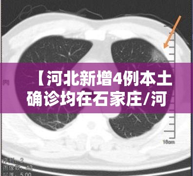 【河北新增4例本土确诊均在石家庄/河北新增新冠肺炎确诊病例14例,石家庄无新增确诊病例】 【河北新增4例本土确诊均在石家庄/河北新增新冠肺炎确诊病例14例,石家庄无新增确诊病例】