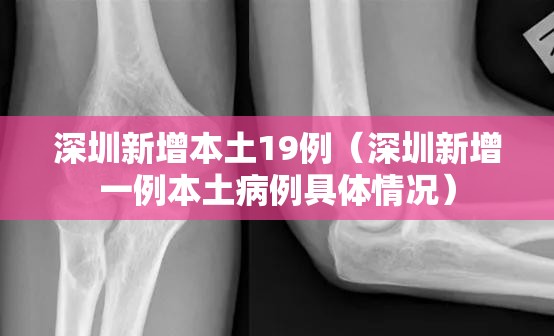 深圳新增本土19例(深圳新增一例本土病例具体情况) 深圳新增本土19例(深圳新增一例本土病例具体情况)