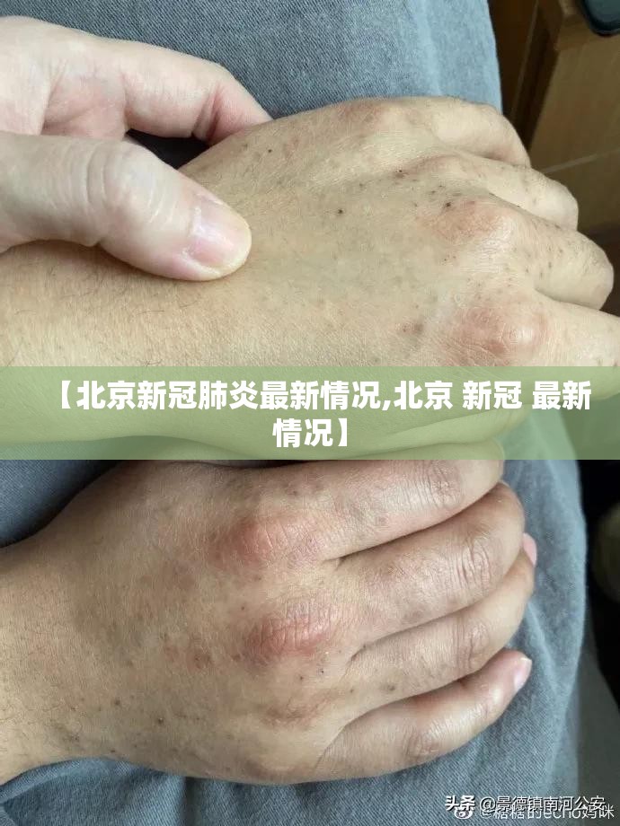 【北京新冠肺炎最新情况,北京 新冠 最新情况】 【北京新冠肺炎最新情况,北京 新冠 最新情况】