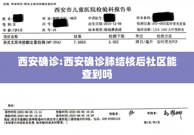 西安确诊:西安确诊肺结核后社区能查到吗 西安确诊:西安确诊肺结核后社区能查到吗