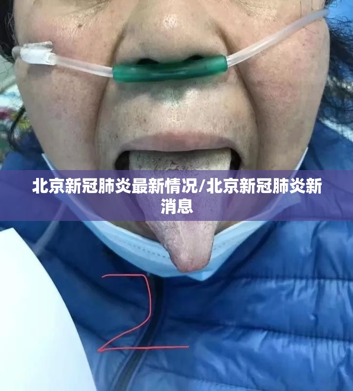 北京新冠肺炎最新情况/北京新冠肺炎新消息 北京新冠肺炎最新情况/北京新冠肺炎新消息