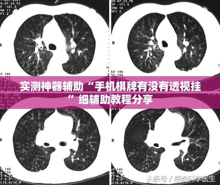 实测神器辅助“手机棋牌有没有透视挂”细辅助教程分享