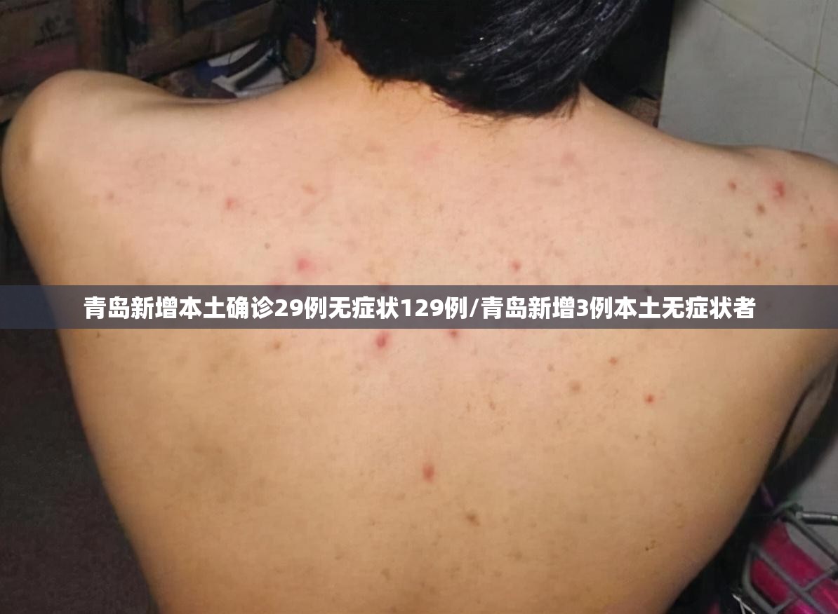 青岛新增本土确诊29例无症状129例/青岛新增3例本土无症状者 青岛新增本土确诊29例无症状129例/青岛新增3例本土无症状者