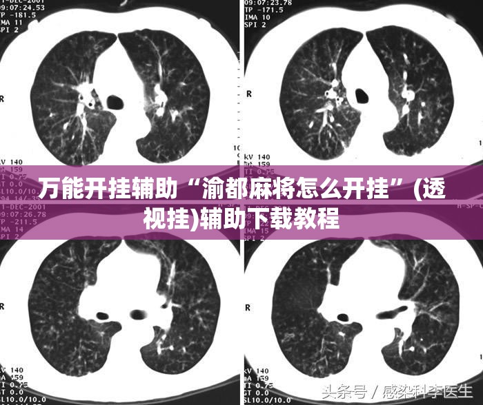万能开挂辅助“渝都麻将怎么开挂”(透视挂)辅助下载教程