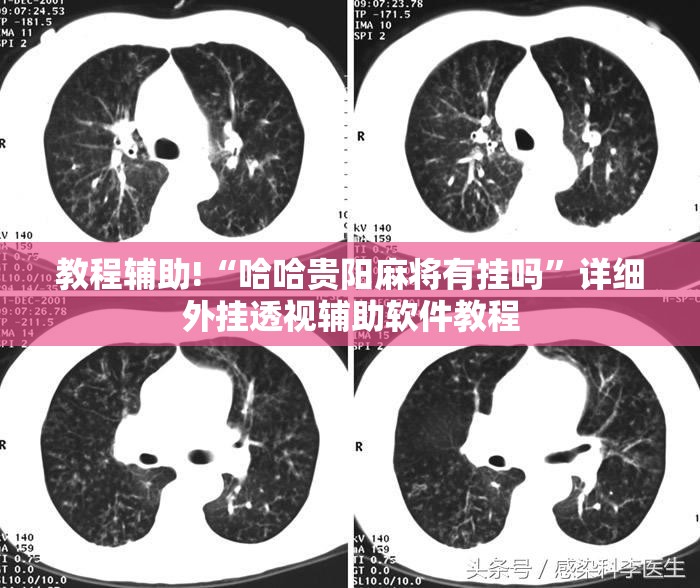 教程辅助!“哈哈贵阳麻将有挂吗	”详细外挂透视辅助软件教程