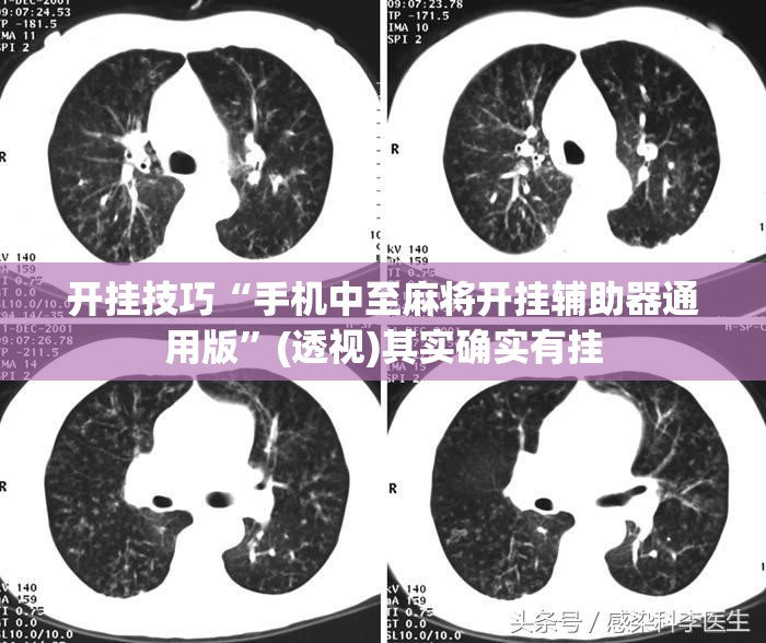 开挂技巧“手机中至麻将开挂辅助器通用版”(透视)其实确实有挂