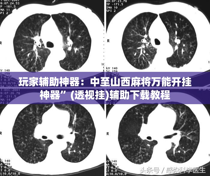 玩家辅助神器：中至山西麻将万能开挂神器	”(透视挂)辅助下载教程