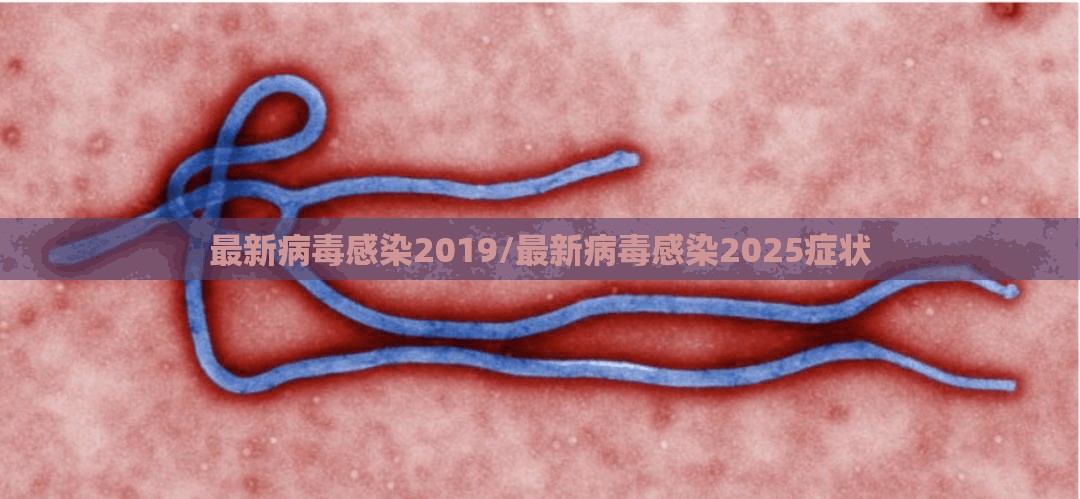 最新病毒感染2019/最新病毒感染2025症状 最新病毒感染2019/最新病毒感染2025症状