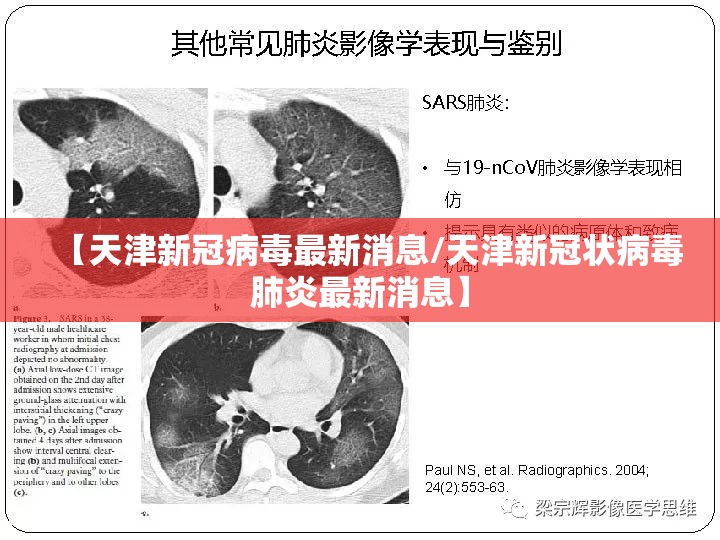 【天津新冠病毒最新消息/天津新冠状病毒肺炎最新消息】 【天津新冠病毒最新消息/天津新冠状病毒肺炎最新消息】