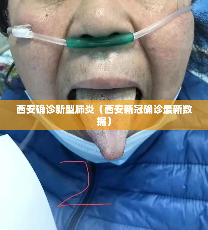 西安确诊新型肺炎(西安新冠确诊最新数据) 西安确诊新型肺炎(西安新冠确诊最新数据)