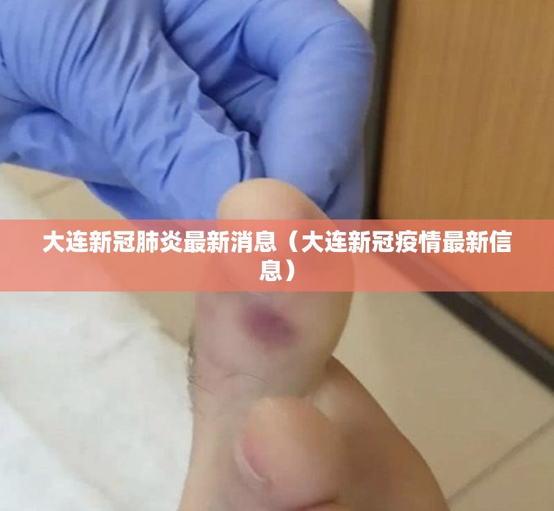 大连新冠肺炎最新消息(大连新冠疫情最新信息) 大连新冠肺炎最新消息(大连新冠疫情最新信息)