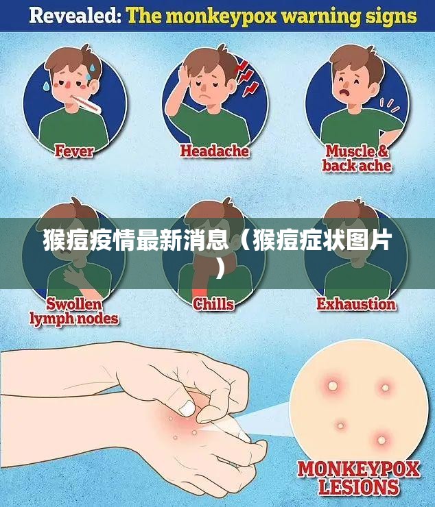 猴痘疫情最新消息(猴痘症状图片) 猴痘疫情最新消息(猴痘症状图片)