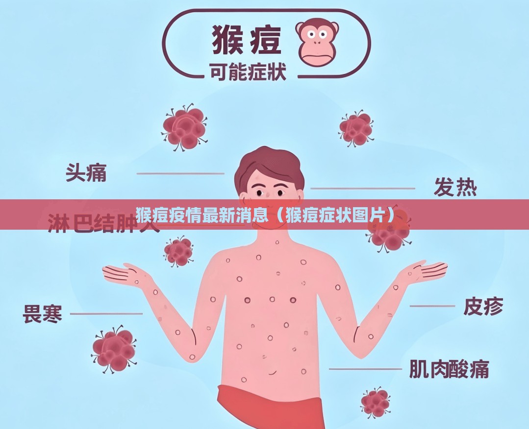 猴痘疫情最新消息(猴痘症状图片) 猴痘疫情最新消息(猴痘症状图片)