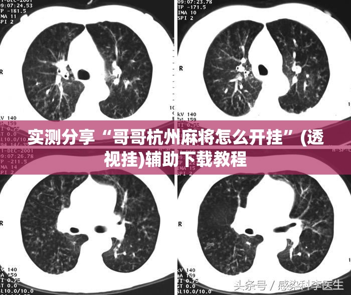 实测分享“哥哥杭州麻将怎么开挂”(透视挂)辅助下载教程