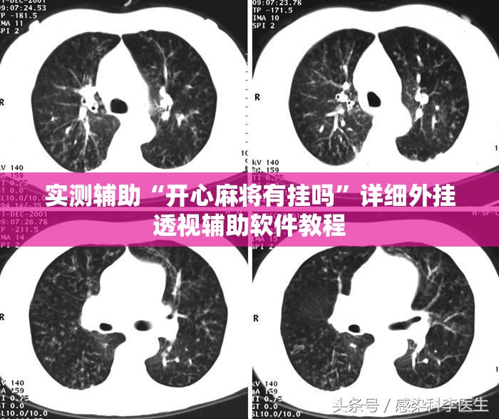 实测辅助“开心麻将有挂吗	”详细外挂透视辅助软件教程