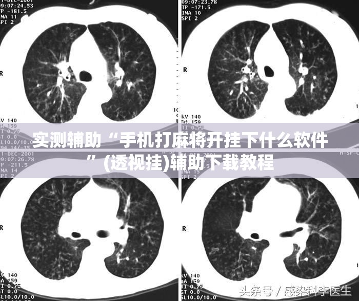 实测辅助“手机打麻将开挂下什么软件”(透视挂)辅助下载教程