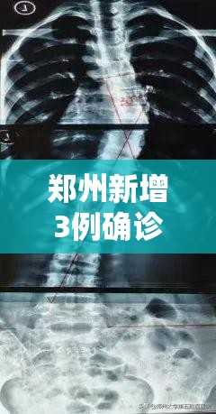 郑州新增3例确诊8例无症状（郑州新增一例无症状感染者发现多例疑似病例）