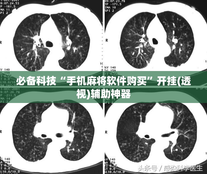 必备科技“手机麻将软件购买”开挂(透视)辅助神器