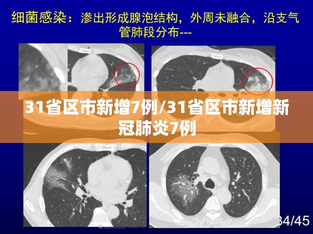 31省区市新增7例/31省区市新增新冠肺炎7例 31省区市新增7例/31省区市新增新冠肺炎7例