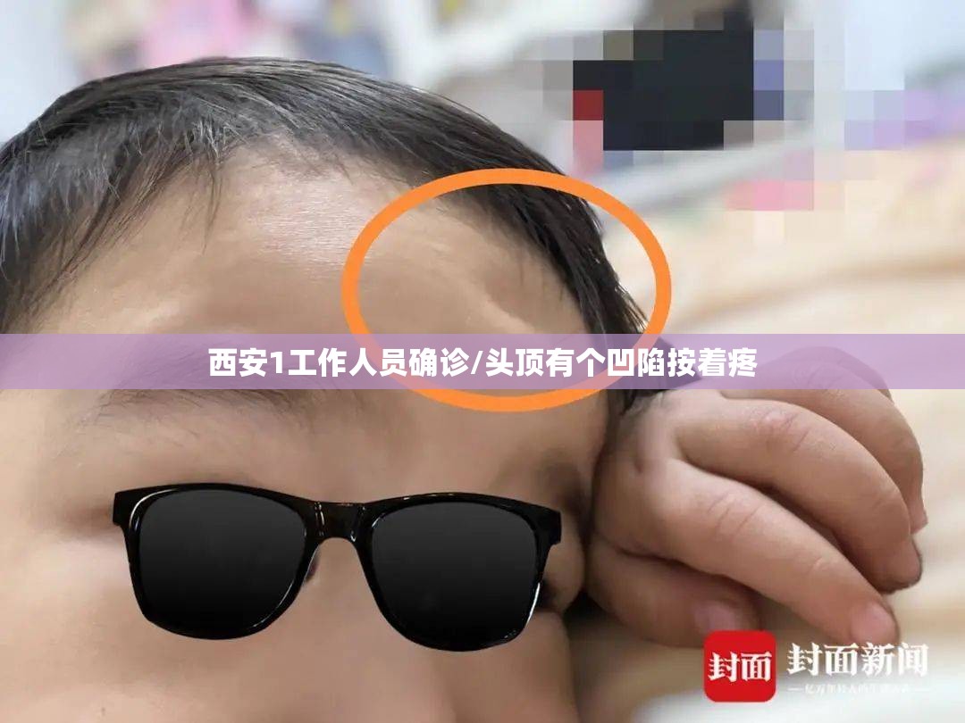 西安1工作人员确诊/头顶有个凹陷按着疼 西安1工作人员确诊/头顶有个凹陷按着疼