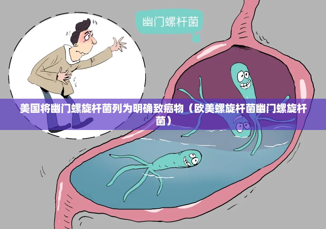 美国将幽门螺旋杆菌列为明确致癌物(欧美螺旋杆菌幽门螺旋杆菌) 美国将幽门螺旋杆菌列为明确致癌物(欧美螺旋杆菌幽门螺旋杆菌)
