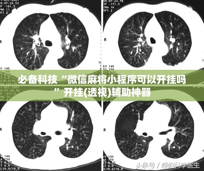 必备科技“微信麻将小程序可以开挂吗”开挂(透视)辅助神器