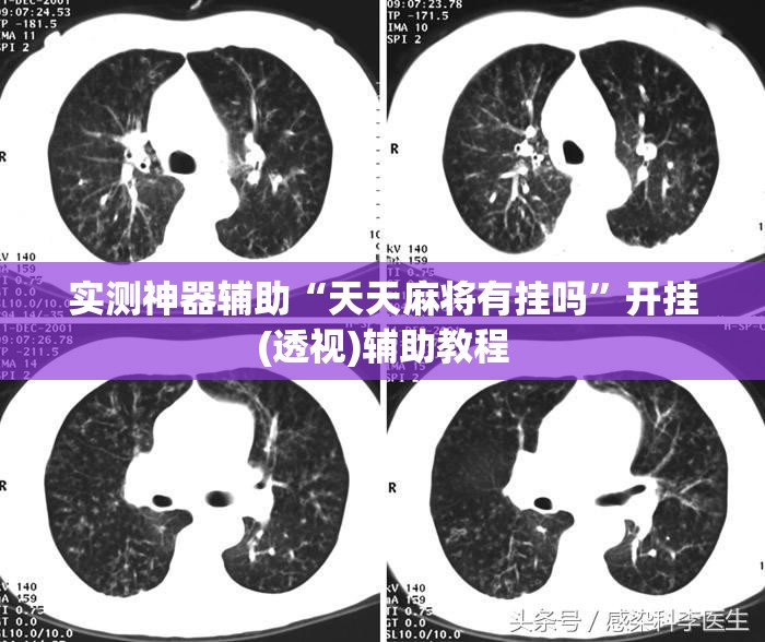 实测神器辅助“天天麻将有挂吗”开挂(透视)辅助教程