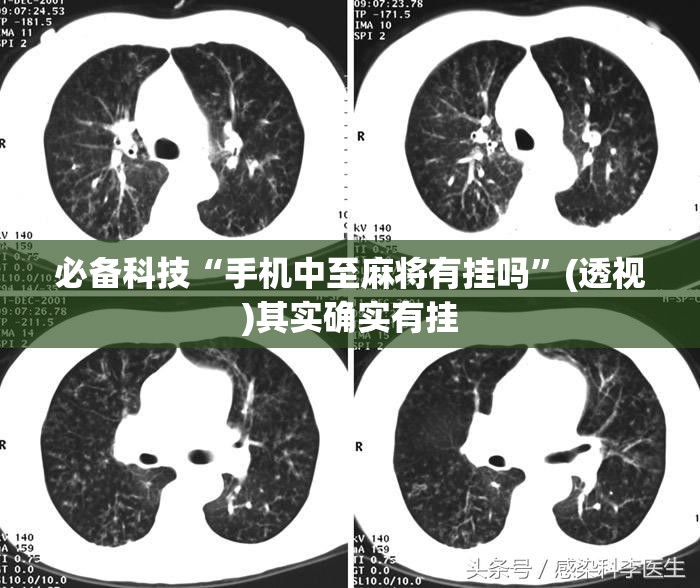 必备科技“手机中至麻将有挂吗”(透视)其实确实有挂