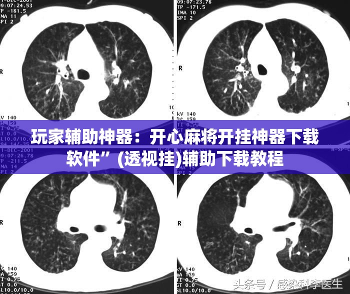 玩家辅助神器：开心麻将开挂神器下载软件	”(透视挂)辅助下载教程