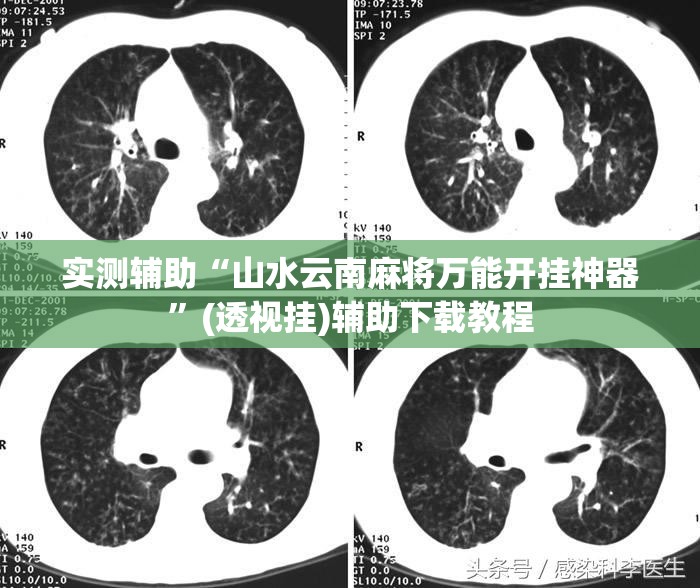 实测辅助“山水云南麻将万能开挂神器”(透视挂)辅助下载教程