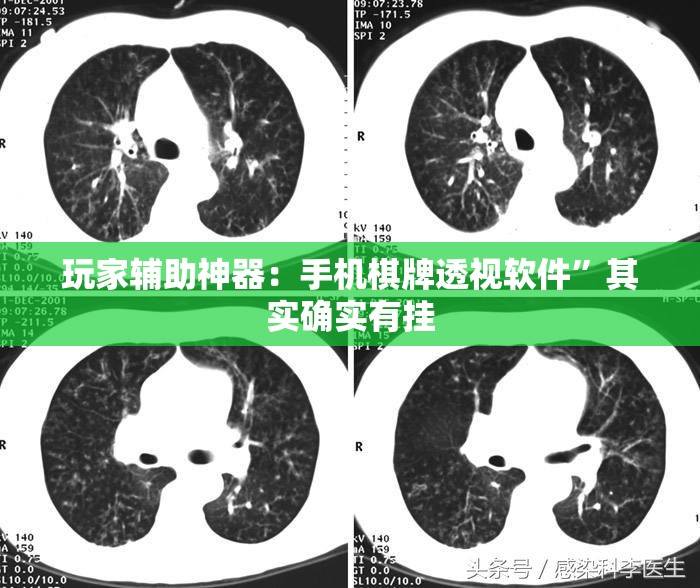 玩家辅助神器：手机棋牌透视软件”其实确实有挂