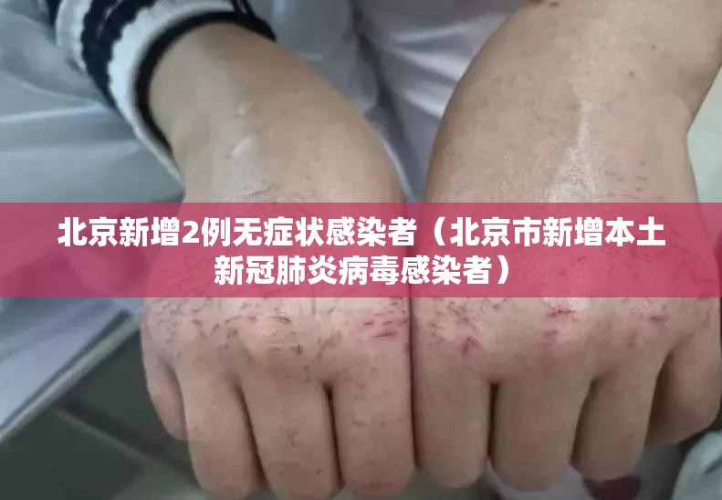 北京新增2例无症状感染者(北京市新增本土新冠肺炎病毒感染者) 北京新增2例无症状感染者(北京市新增本土新冠肺炎病毒感染者)
