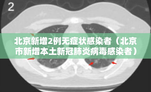 北京新增2例无症状感染者(北京市新增本土新冠肺炎病毒感染者) 北京新增2例无症状感染者(北京市新增本土新冠肺炎病毒感染者)