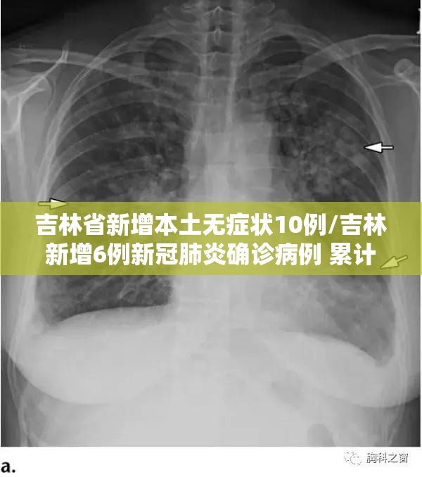 吉林省新增本土无症状10例/吉林新增6例新冠肺炎确诊病例 累计23例