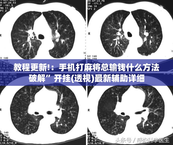 教程更新!：手机打麻将总输钱什么方法破解”开挂(透视)最新辅助详细