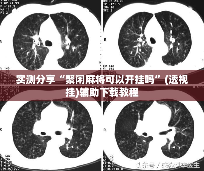 实测分享“聚闲麻将可以开挂吗”(透视挂)辅助下载教程
